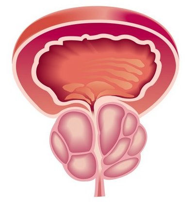 Erecție nocturnă cu prostatită. Erectie nocturna din prostatita